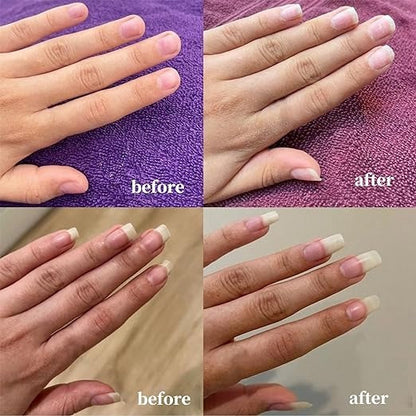 Nail Growth AndStrengthening Serum