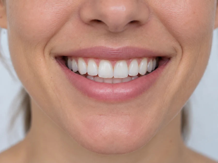Illustrative tooth view, not a documented Lazzda treatment result