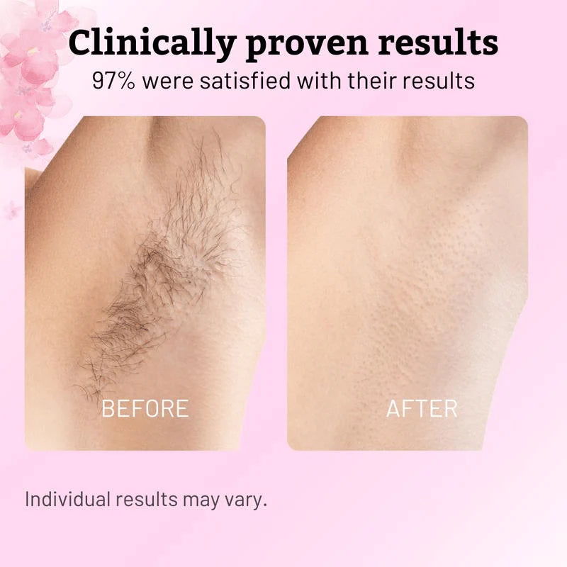 ✨ Caramela Beauty Cyperus Rotundus Öl zur natürlichen, dauerhaften Haarreduktion