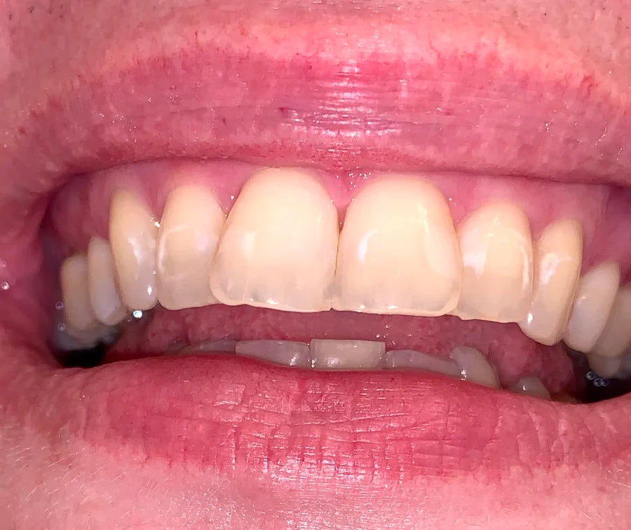 Customer review portrait for purple toothpaste tablets