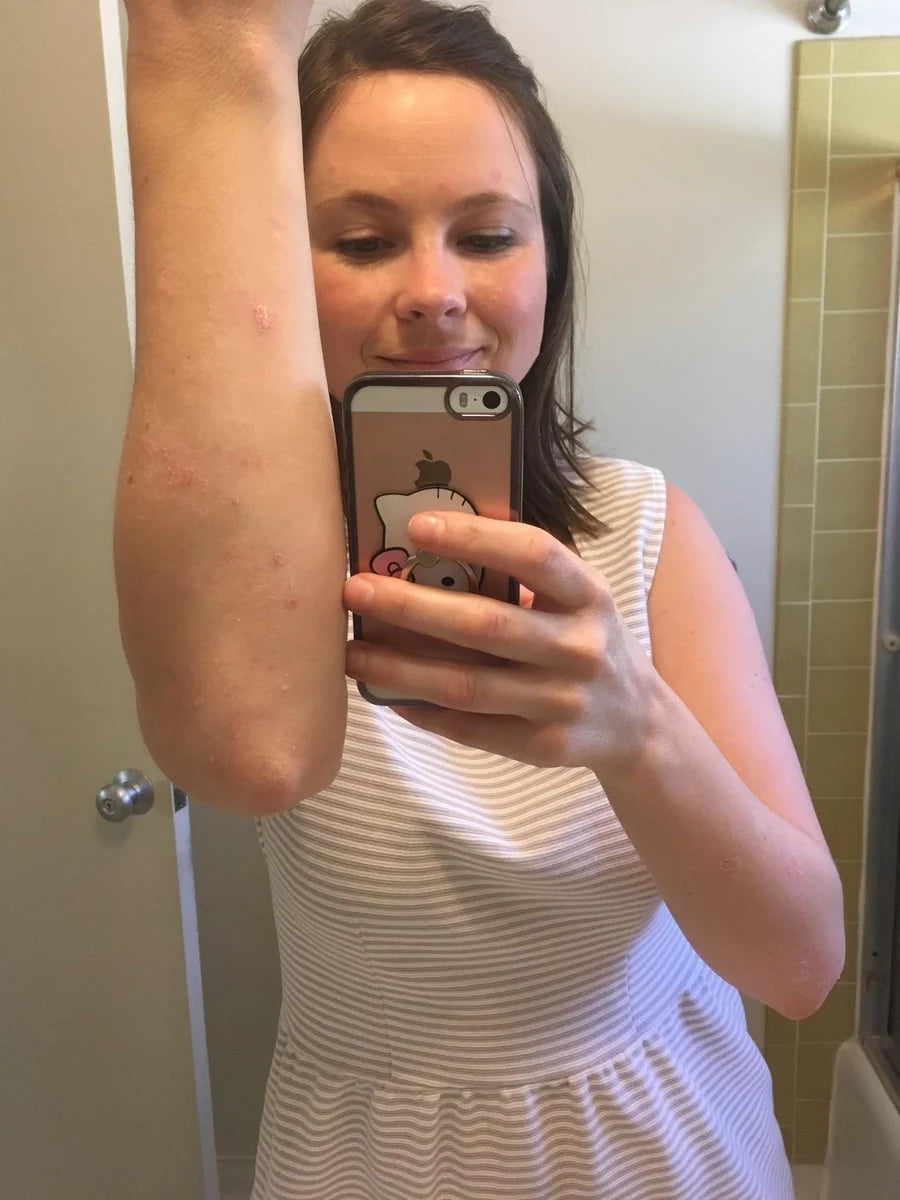 Placeholder portrait for an illustrative Lazzda skin-care review