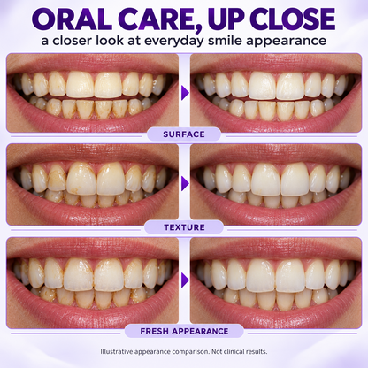 🇨🇦👨‍⚕️✅️👍Advanced Formula🦷Lazzda GumRevive Periodontal Repair Gel