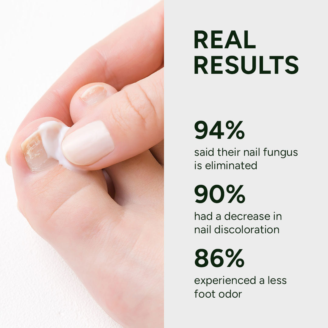 Gel de traitement contre les mycoses des ongles